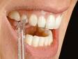Waterpik vs Flossing by Coolsmiles Orthodontics